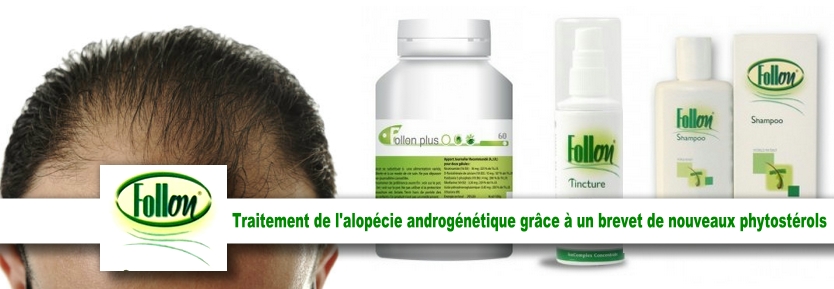 follon alopécie chute des cheveux