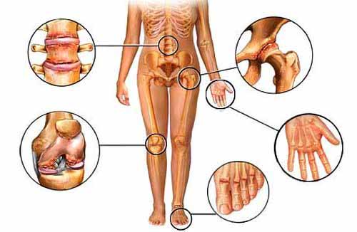 curcuma articulations