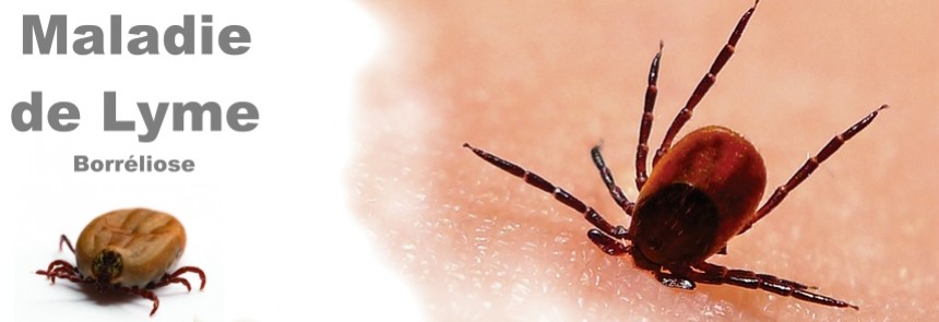 La maladie de Lyme