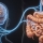 Syndrome de l'intestin irritab