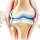 Arthrose : les 4 composants qu