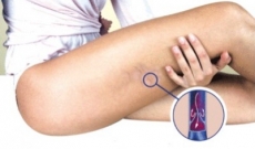Circulation et jambes lourdes